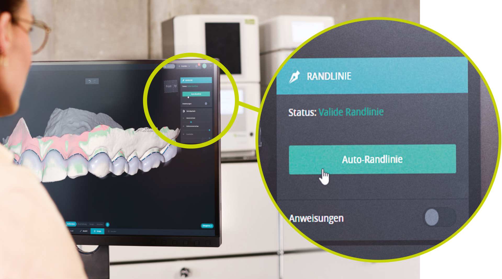 DentaMile bite splint workflow Auto Margin Line