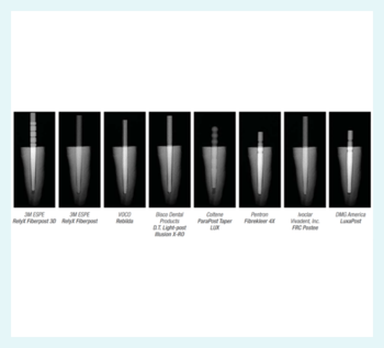 Posts in the X-ray image