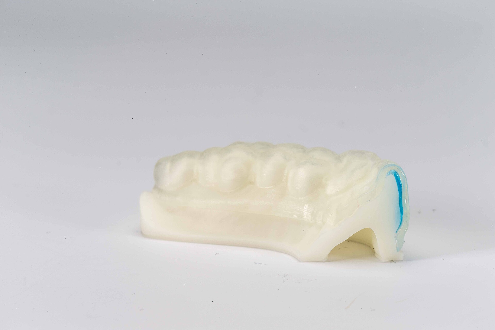 DMG DentaMile bleaching tray
