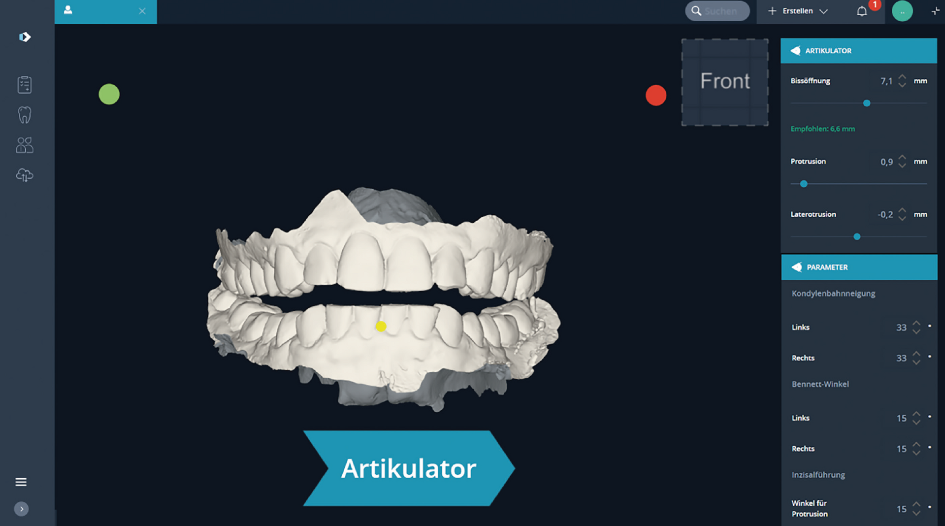 DentaMile bite splint workflow Articulator