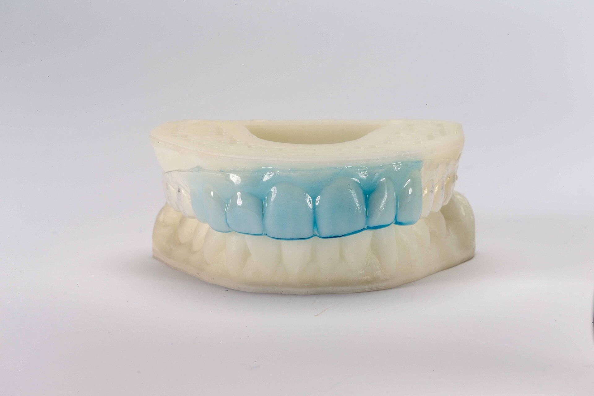 Thermoplastic bleaching tray