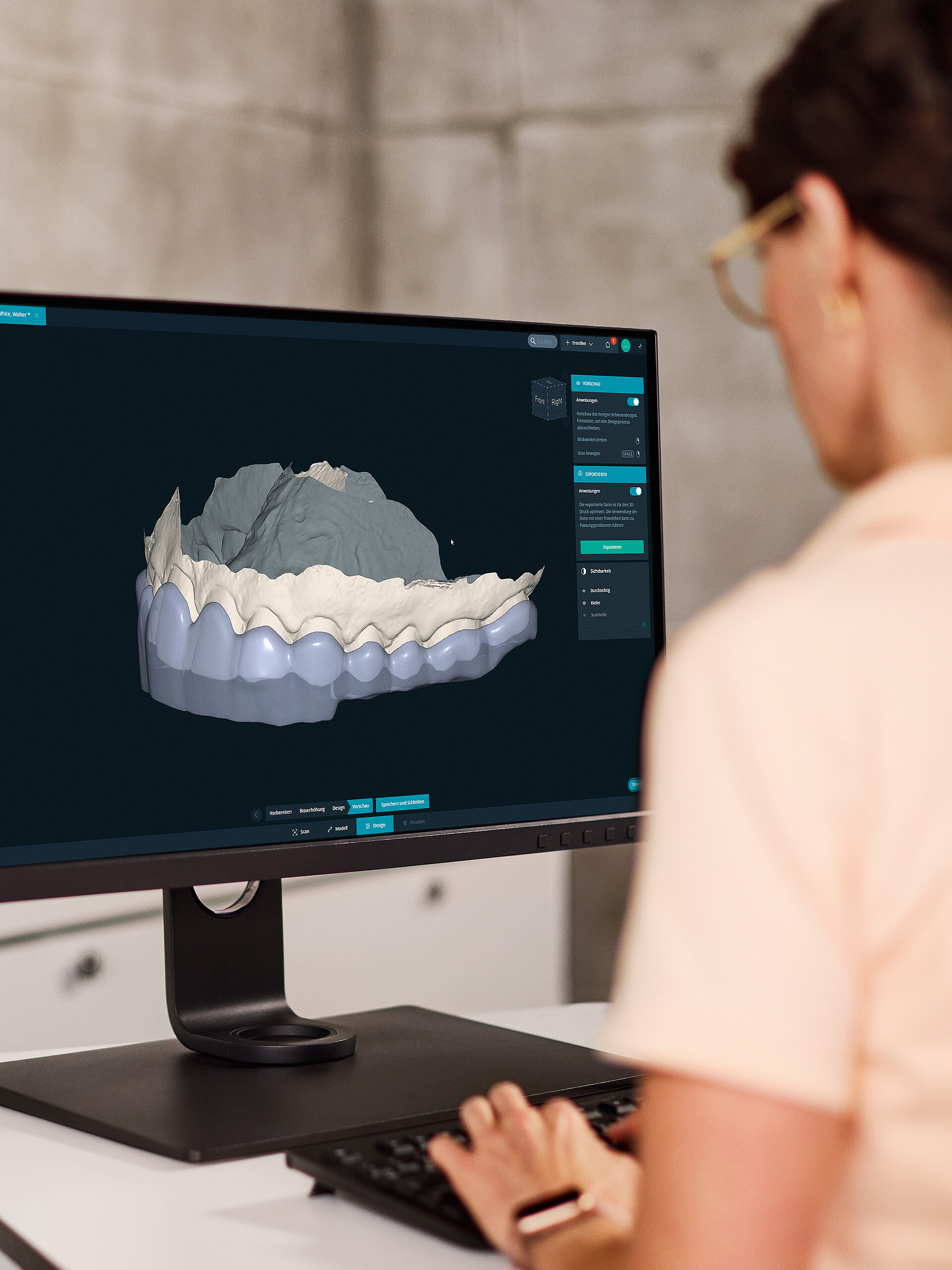 DentaMile bite splint workflow WIN