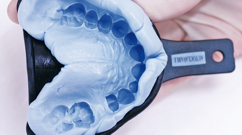 StatusBlue | Temporary fabrication and opposing jaw impression | Pourable multiple times and stable in storage Mass in impression tray