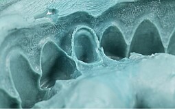 Impresión del arco dental