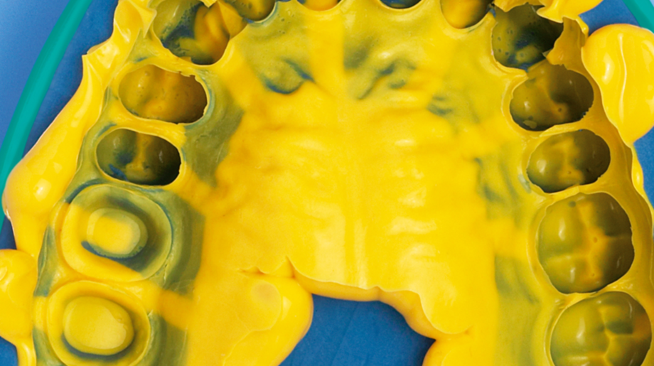 Honigum Putty | VPS for mixing by hand | Excellent recovery after deformation Blue and yellow mass in the mouth