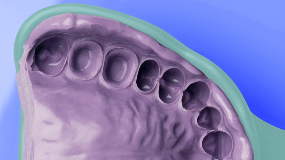 Silagum Mono | Fixation impression | Stability and flowability Moulded mass in the tray