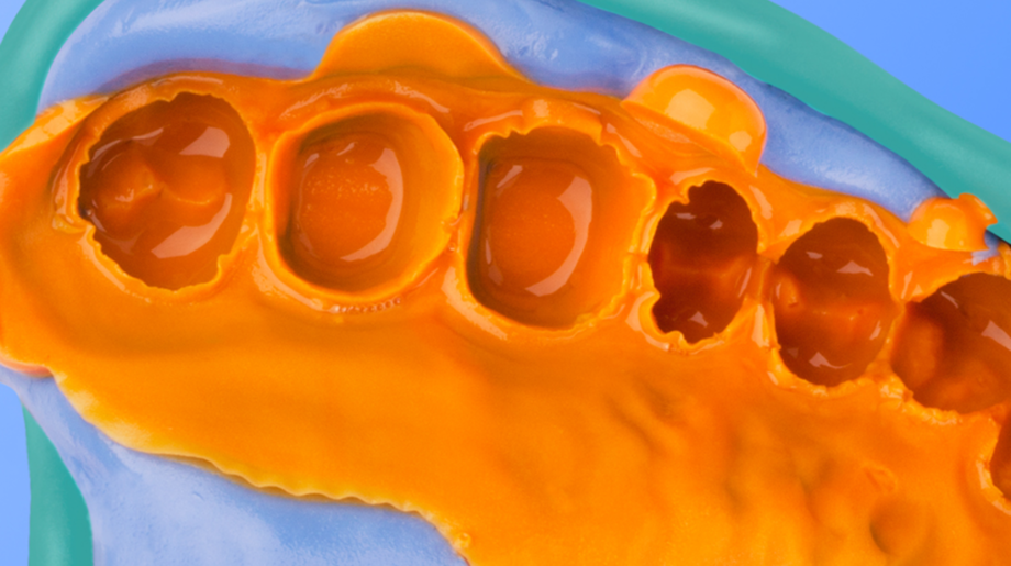 Silagum Light | Corrective bite registration material | Free-flowing, normal- and fast-curing Orange mass in the tray