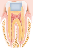Imagen: sección transversal de un diente