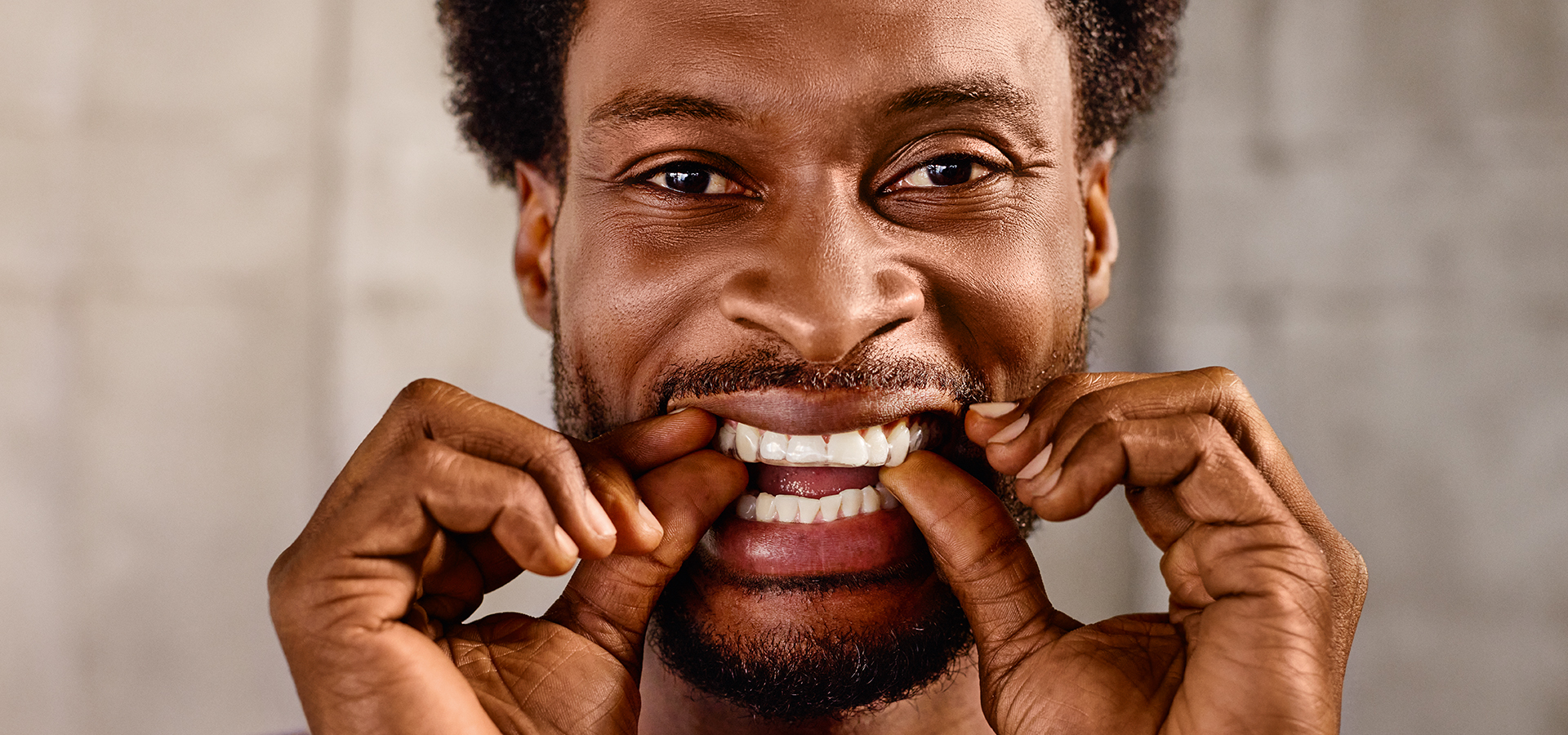 DentaMile bite splint workflow Result Patient