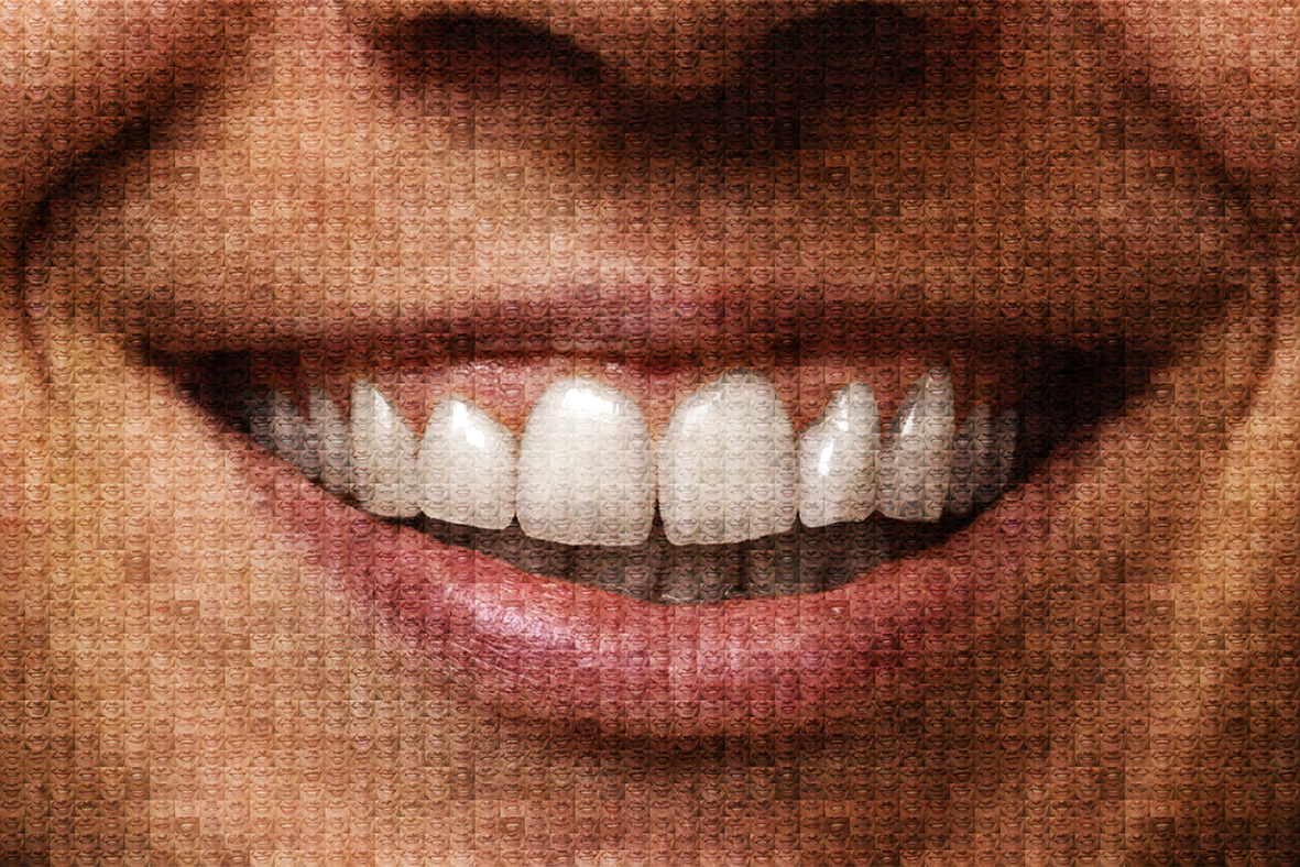 Image of a smile made up of multiple small images of a smile. 
